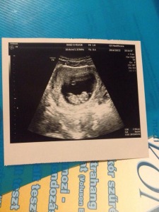 10745020_644156949036738_905643012_n